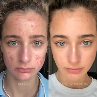 Crème visage clarifiante