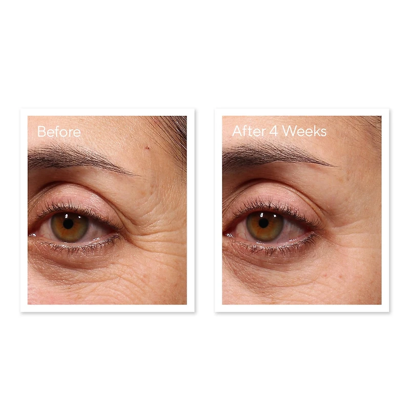 Sérum rénovateur pour les yeux Retinol Youth