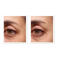 Sérum rénovateur pour les yeux Retinol Youth