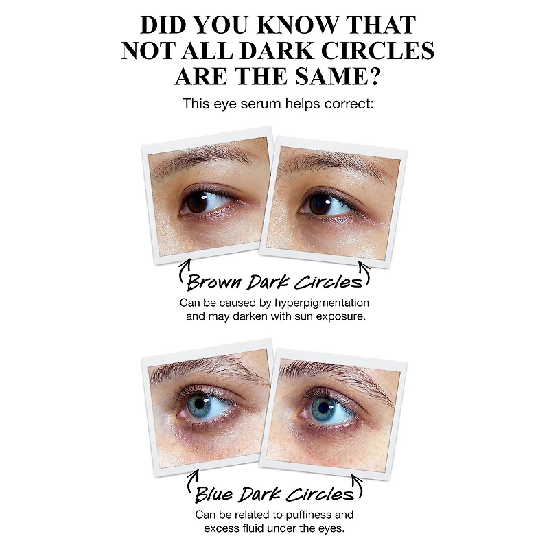 Sérum pour les yeux anticernes puissant avec vitamine C
