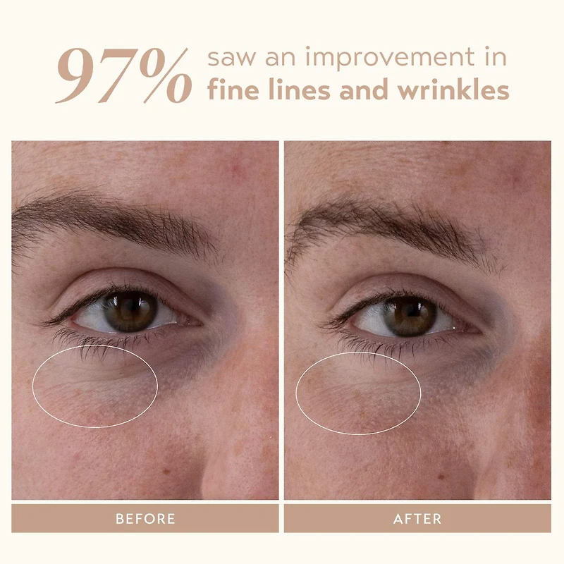 Sérum régénérateur au rétinol Retinol Reform®