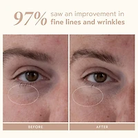 Sérum régénérateur au rétinol Retinol Reform®