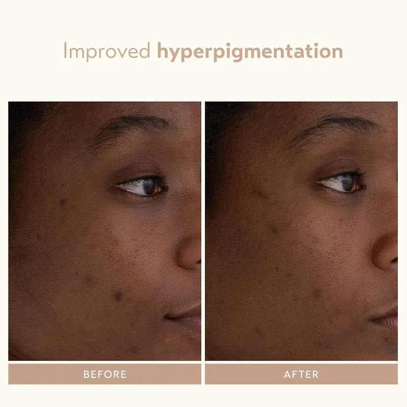 Sérum régénérateur au rétinol Retinol Reform®