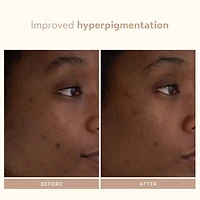 Sérum régénérateur au rétinol Retinol Reform®