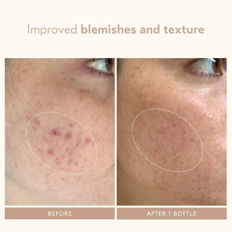 Sérum régénérateur au rétinol Retinol Reform®