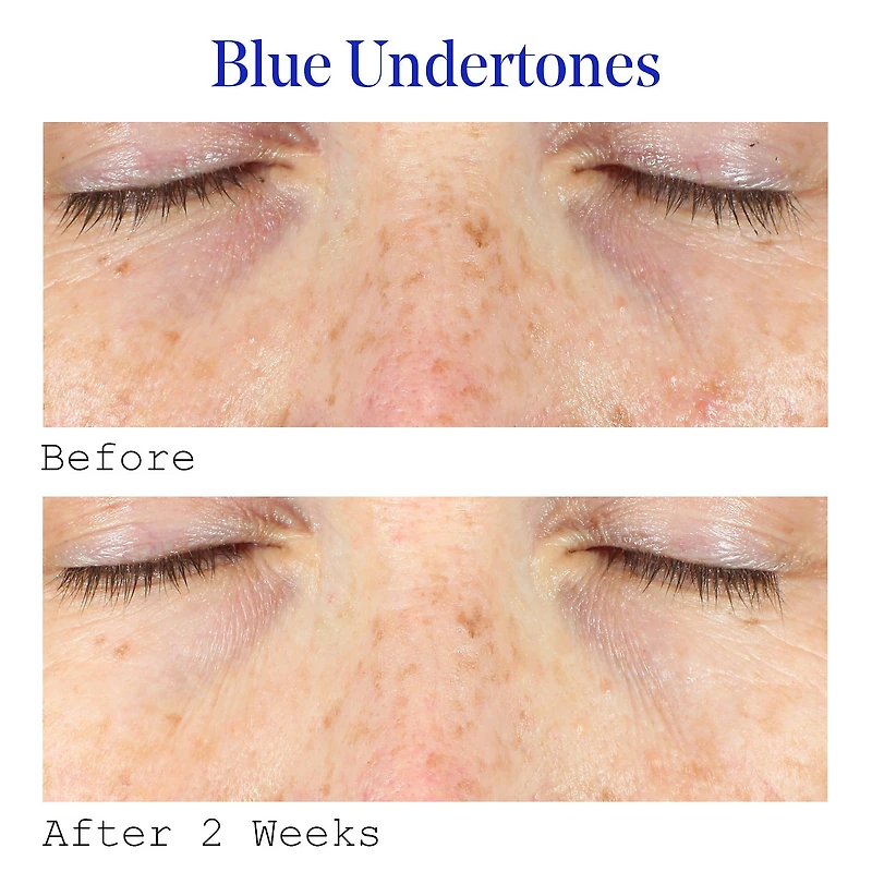 Sérum pour les yeux correcteur de cernes à la vitamine C