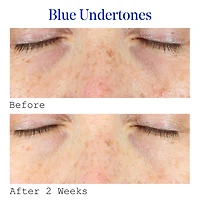 Sérum pour les yeux correcteur de cernes à la vitamine C