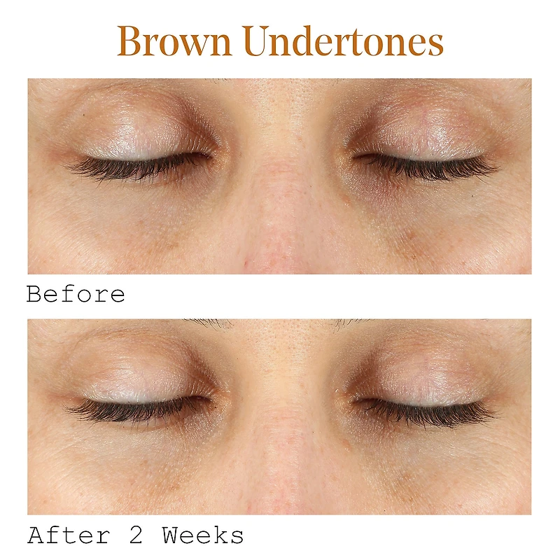 Sérum pour les yeux correcteur de cernes à la vitamine C