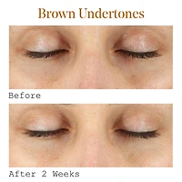 Sérum pour les yeux correcteur de cernes à la vitamine C