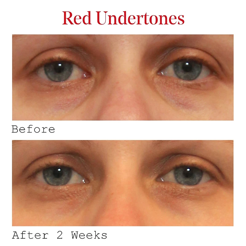 Sérum pour les yeux correcteur de cernes à la vitamine C