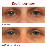 Sérum pour les yeux correcteur de cernes à la vitamine C