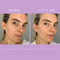 Crème réparatrice DeliKate™