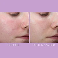 DeliKate™ Recovery Serum