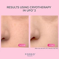 UFO™ 2