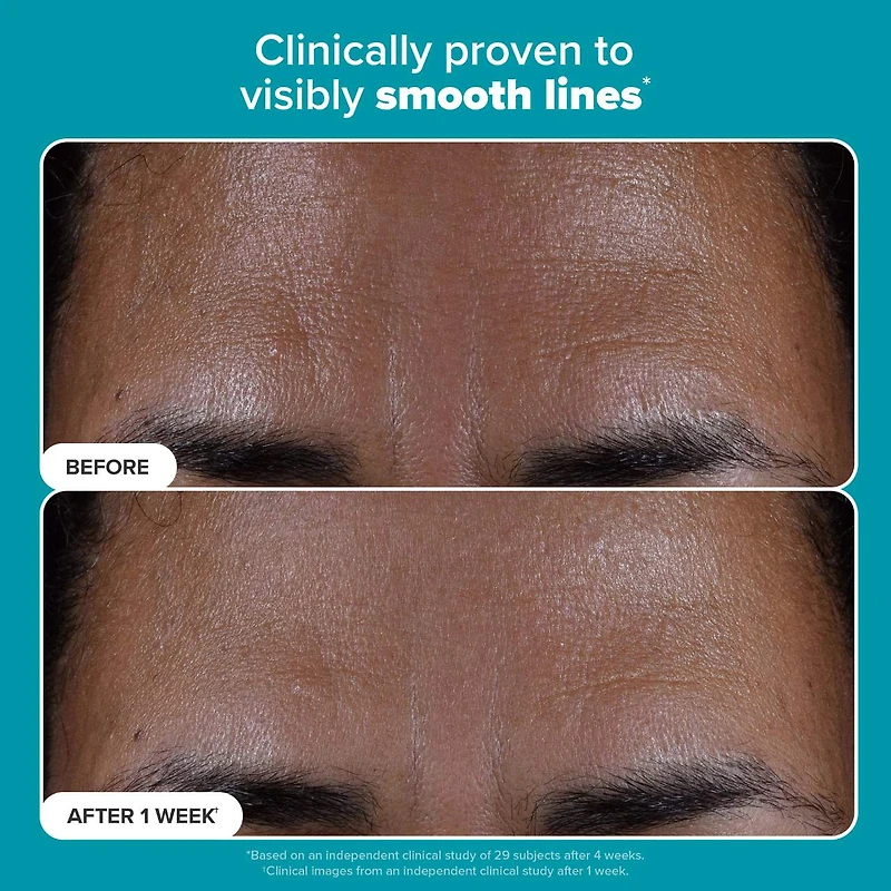 Mini Skin Perfecting 2% BHA Exfoliating Toner for Clear Skin