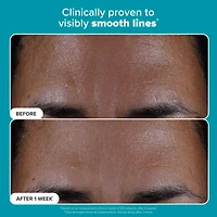 Mini Skin Perfecting 2% BHA Exfoliating Toner for Clear Skin