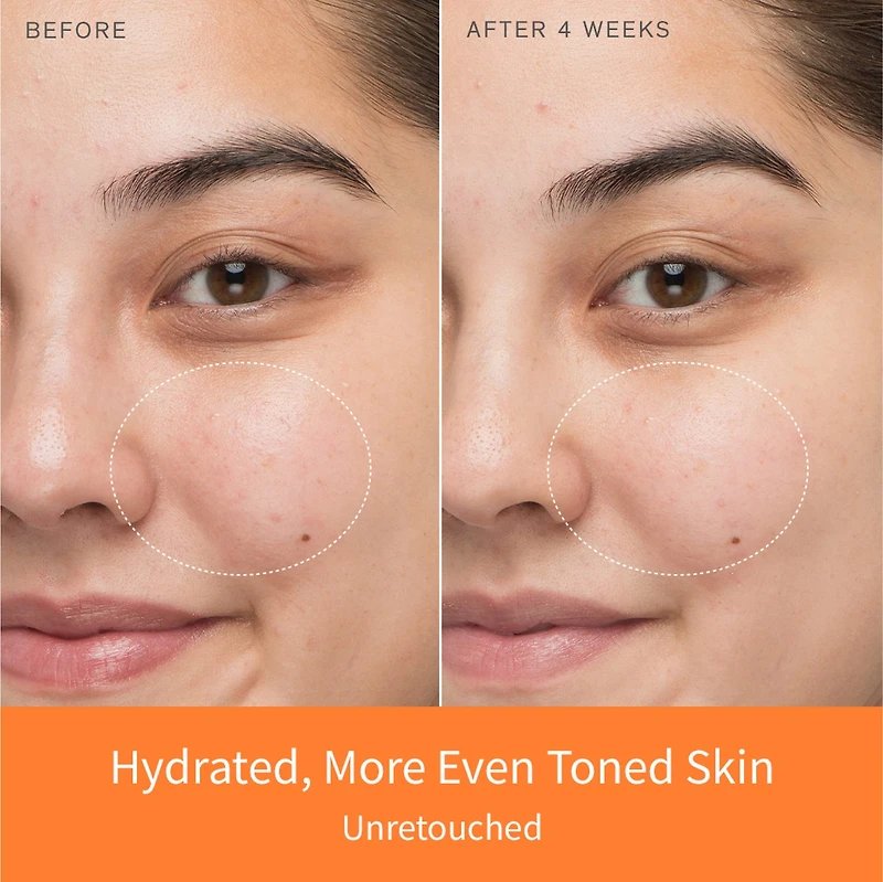 First Care Activating Serum for Anti-Aging