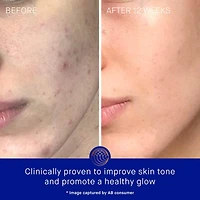 Hydratant pour le visage The Cream avec TFC8®
