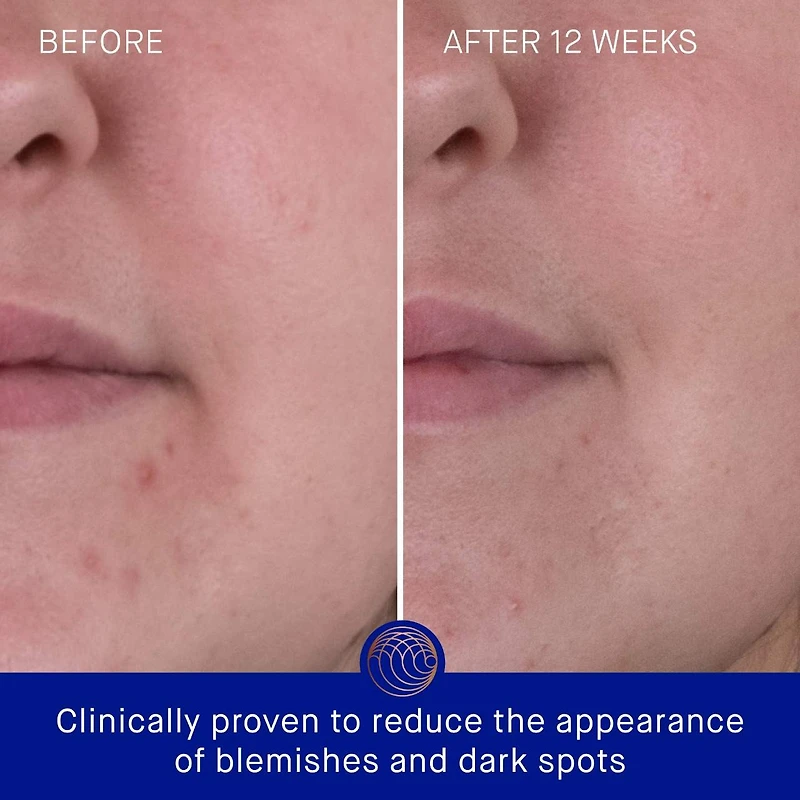 Hydratant pour le visage mini crème riche avec TFC8