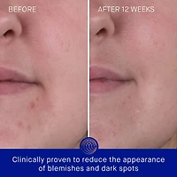 Hydratant pour le visage mini crème riche avec TFC8