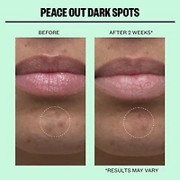 Microneedling Dark Spot Brightening Dots