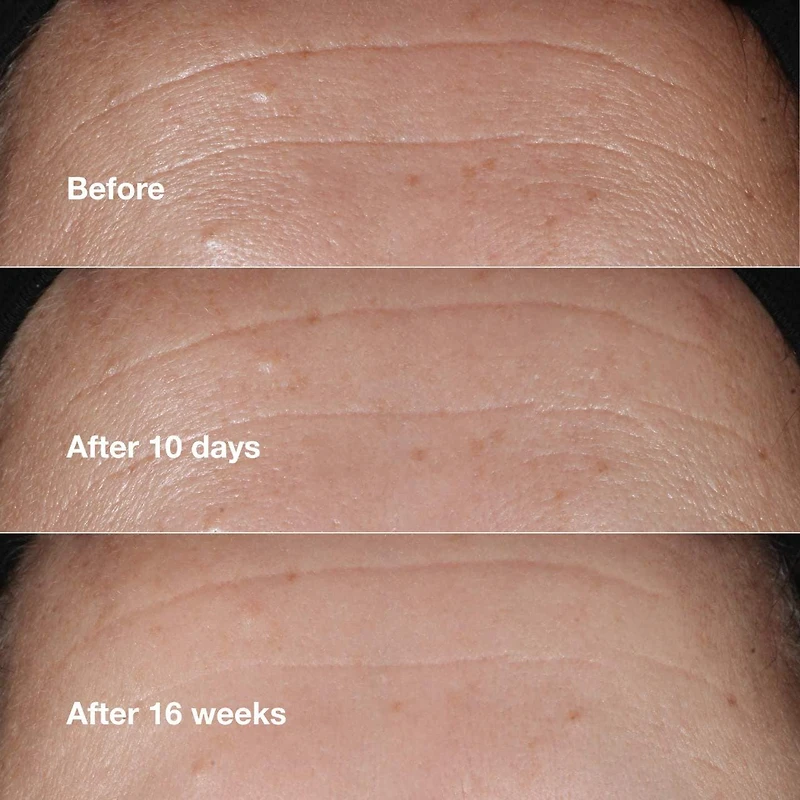 Sérum correcteur de rides Smart Clinical Repair™