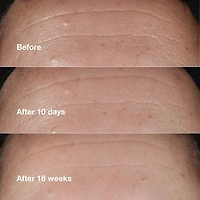 Sérum correcteur de rides Smart Clinical Repair™
