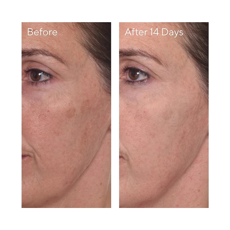 Mini Rapid Dark Spot Correcting Serum