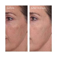Mini Rapid Dark Spot Correcting Serum