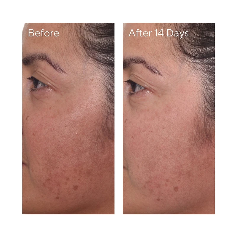 Mini Rapid Dark Spot Correcting Serum