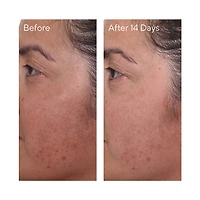 Mini Rapid Dark Spot Correcting Serum