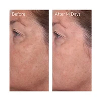 Mini Rapid Dark Spot Correcting Serum