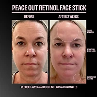 Retinol Face Stick