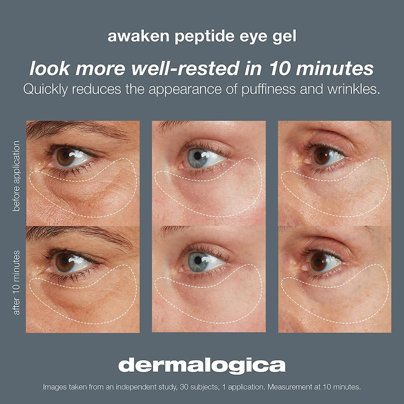 Gel anti-poches sous les yeux