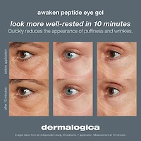 Gel anti-poches sous les yeux