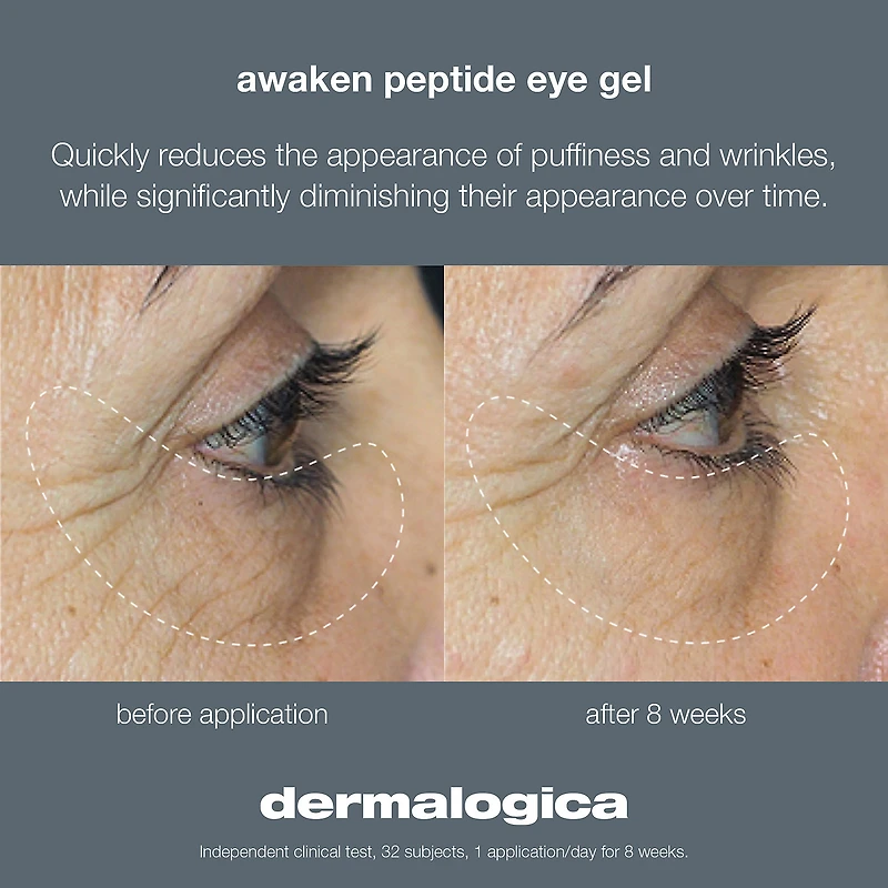 Gel anti-poches sous les yeux
