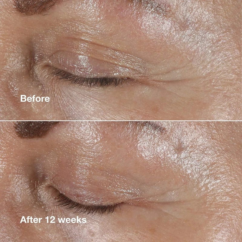 Crème correctrice des ridules pour contour des yeux Smart Clinical Repair™