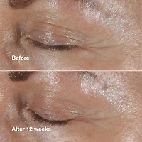 Crème correctrice des ridules pour contour des yeux Smart Clinical Repair™