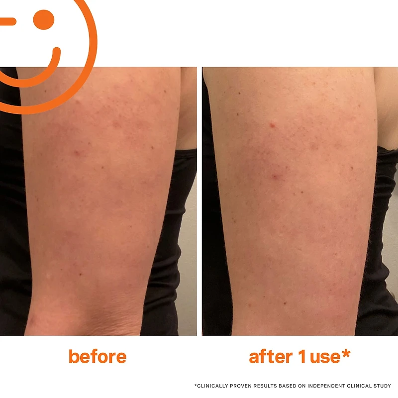 Exfoliant pour le corps ExfoliKate™ avec AHA, BHA et caféine