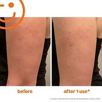 Exfoliant pour le corps ExfoliKate™ avec AHA, BHA et caféine