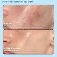 Gel-crème régénérant la barrière cutanée et affinant les pores avec niacinamide