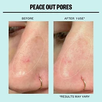 Peace Out Oil-Absorbing Pore Treatment Strips