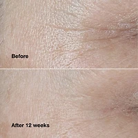 Crème correctrice de rides Smart Clinical Repair™