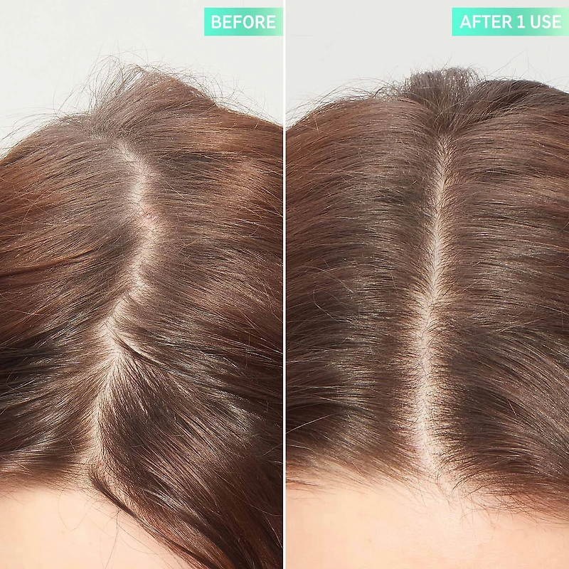 Exfoliant pour cuir chevelu à l’acide glycolique