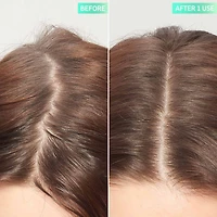 Exfoliant pour cuir chevelu à l’acide glycolique