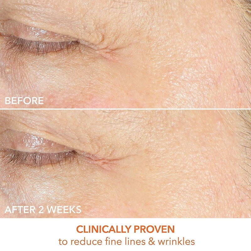 Soin pour les yeux raffermissant et lumineux à la vitamine C lactique
