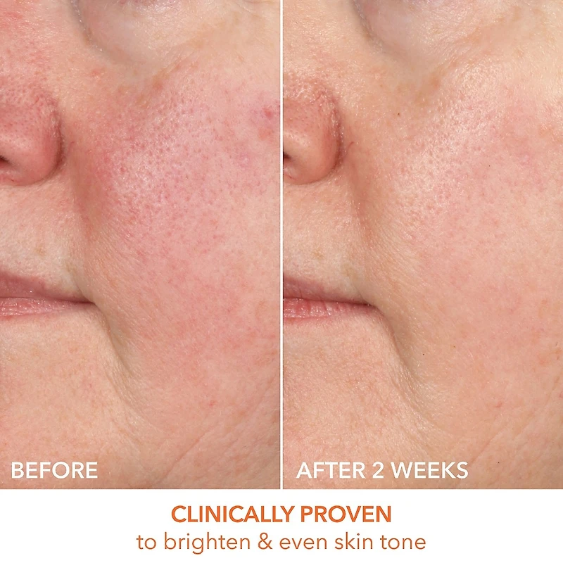 Vitamin C Lactic 15% Firm & Bright Serum