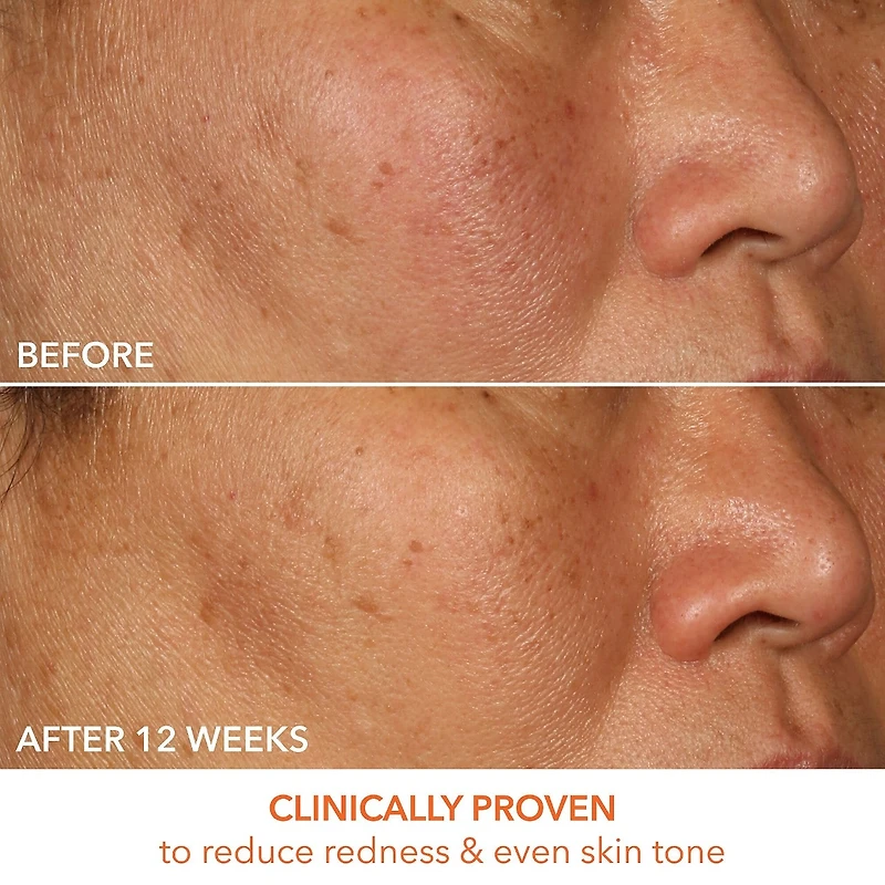 Sérum raffermissant et illuminant avec 15 % de vitamine C lactique