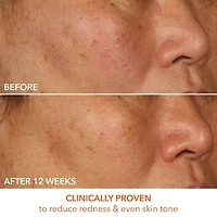 Sérum raffermissant et illuminant avec 15 % de vitamine C lactique