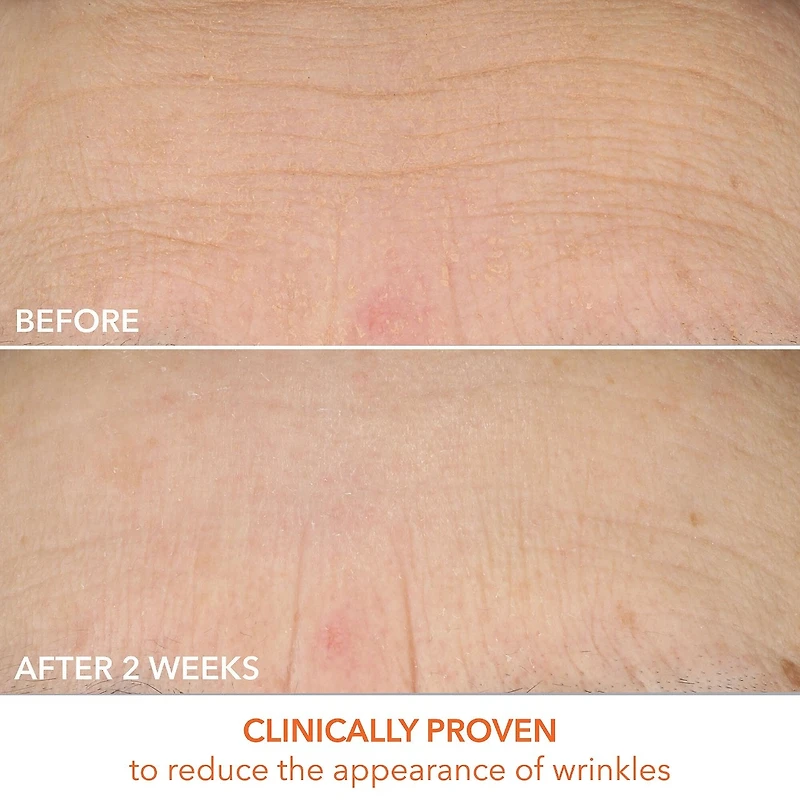 Vitamine C Crème profonde Lactic Dewy